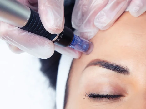Hydrafacial Cilt Bakımı: Aşamalar ve Faydaları